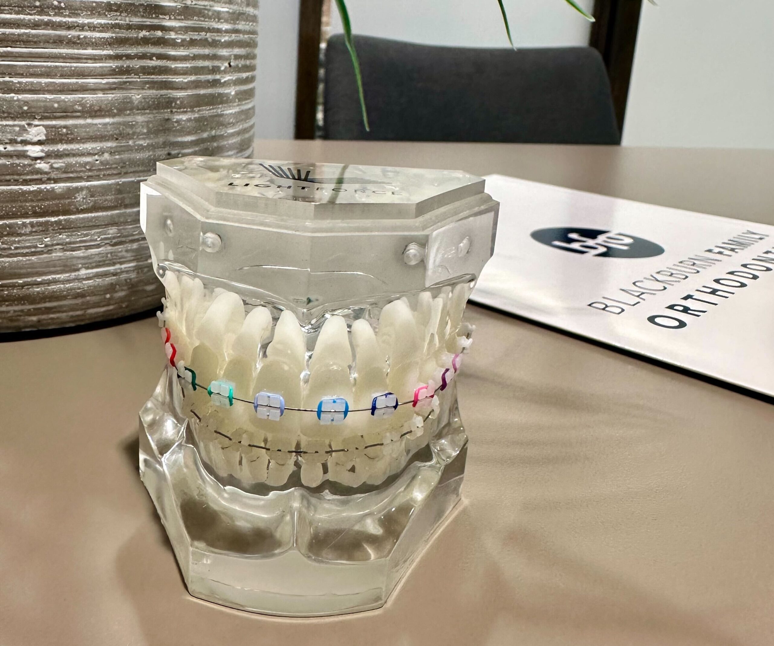 Lightforce Ceramic Braces at Blackburn Family Ortho