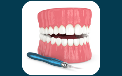 How Laser Technology Is Transforming Orthodontics in Fulshear and Katy, TX
