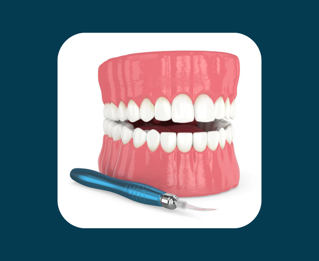 later treatment in orthodontics